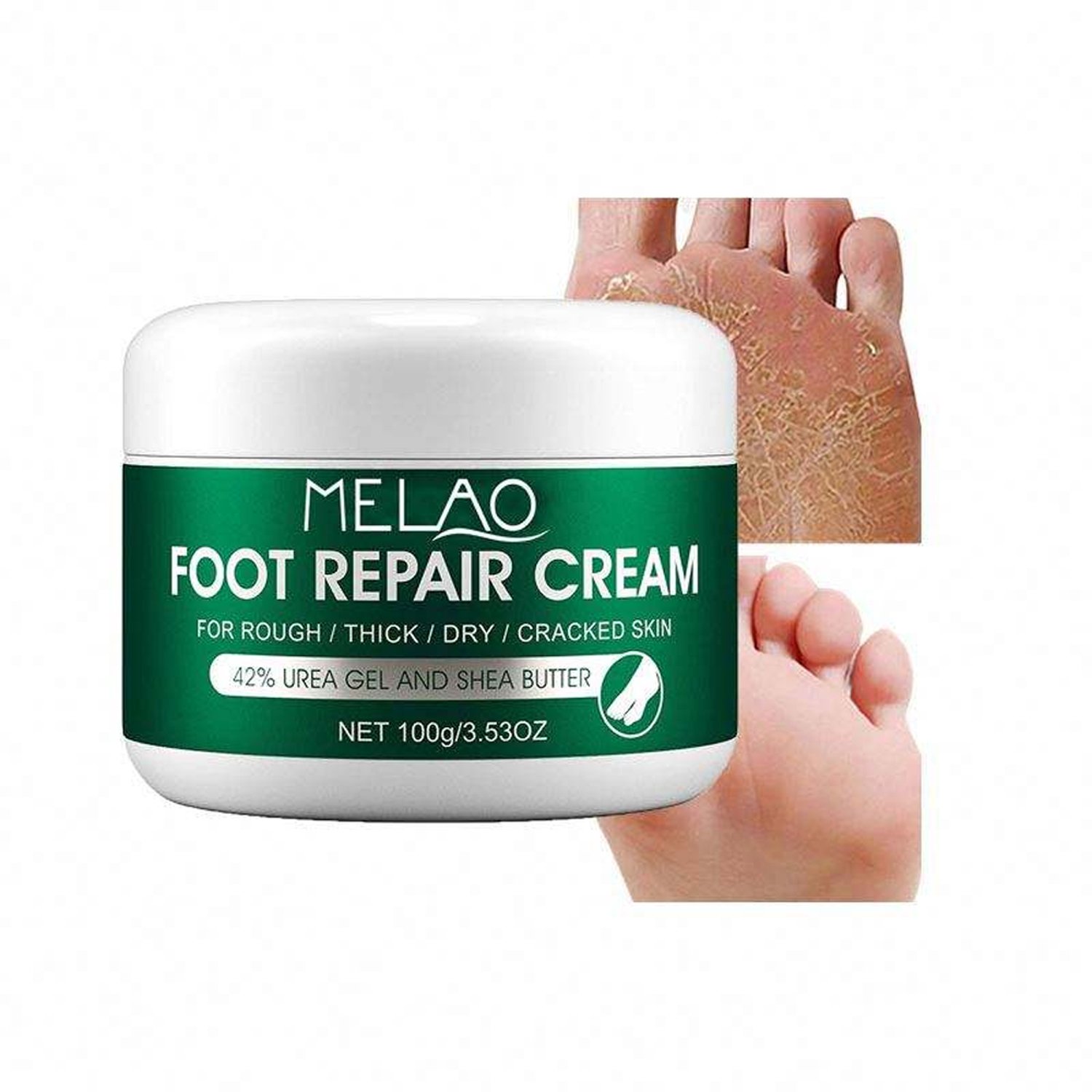 MELAO Foot Repair Cracked Heel Cream - 100g - Image 2