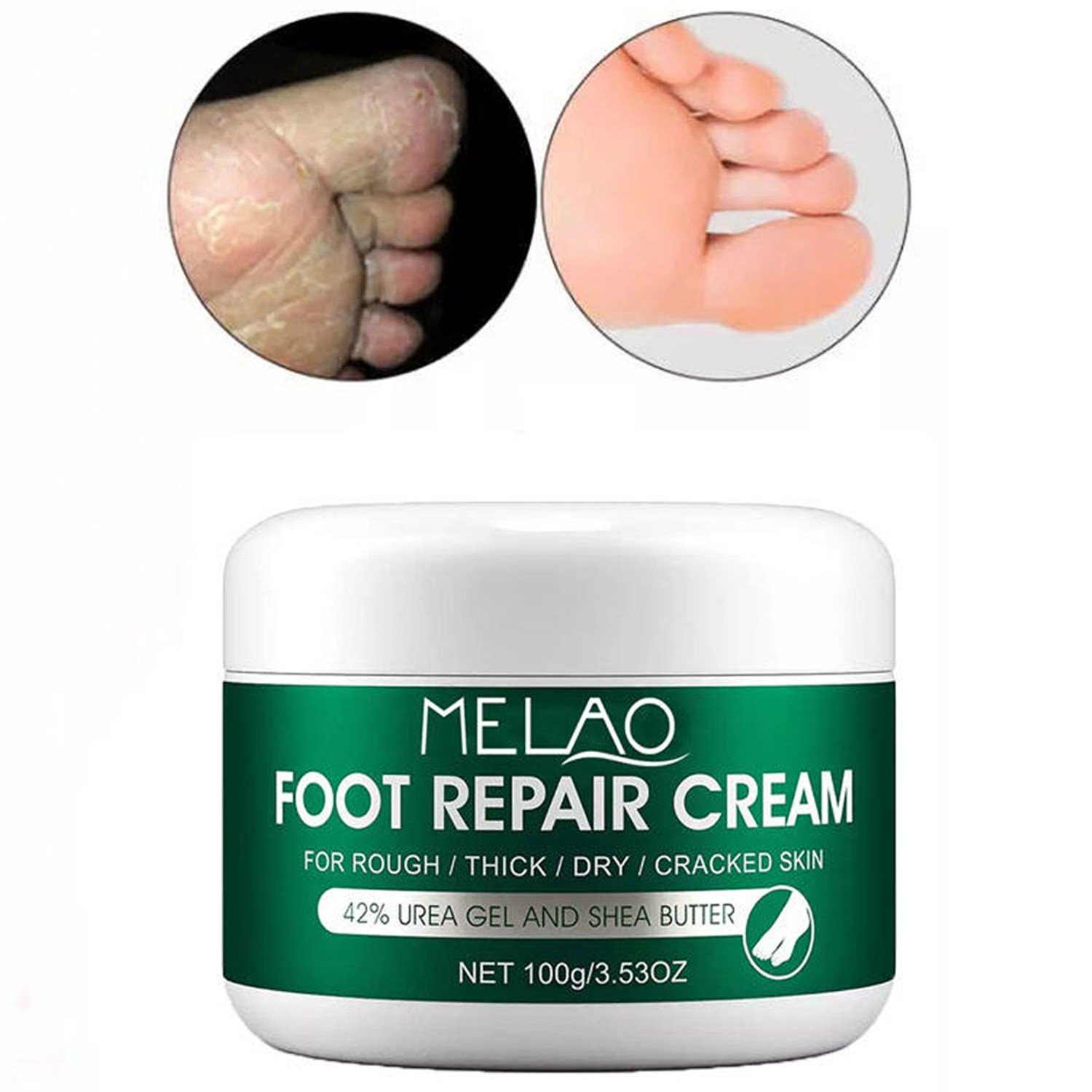 MELAO Foot Repair Cracked Heel Cream - 100g - Image 3
