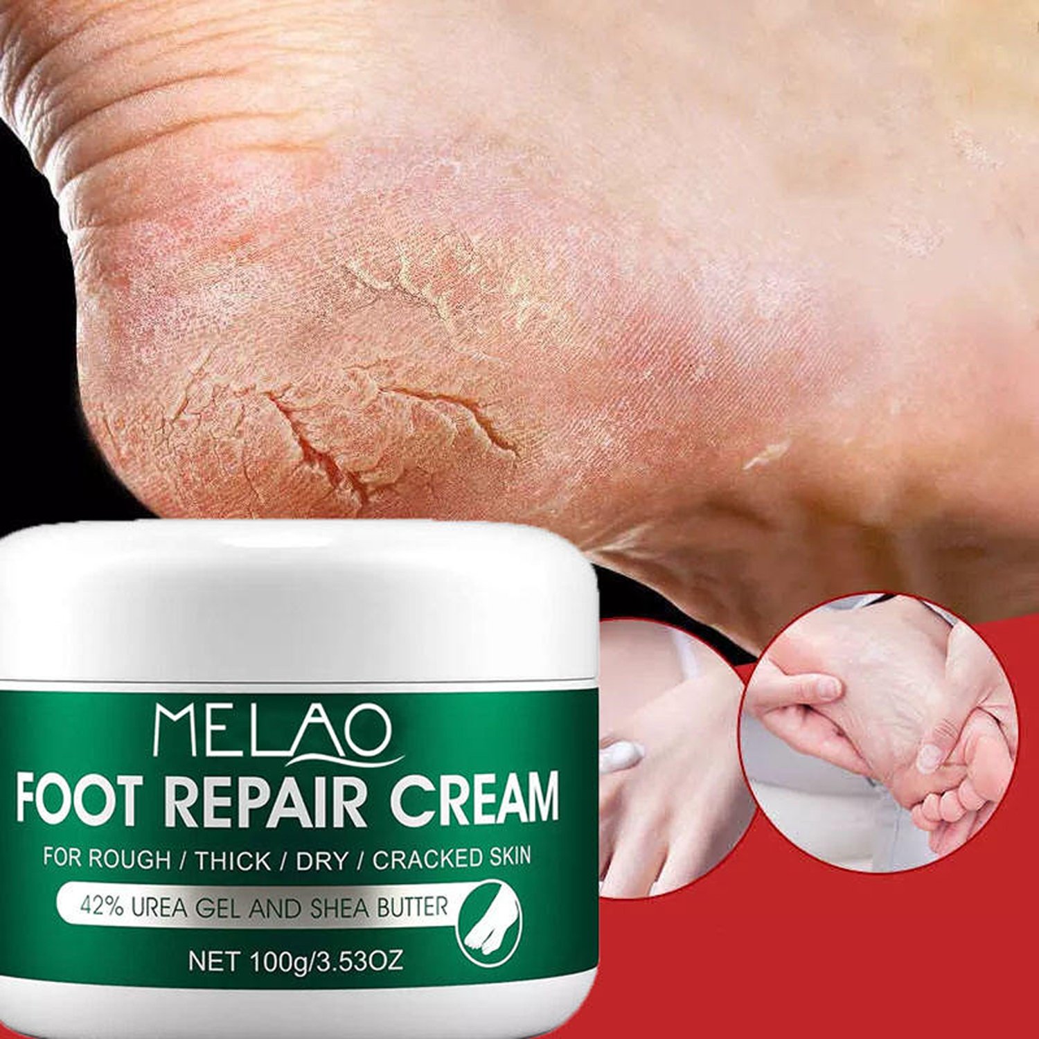 MELAO Foot Repair Cracked Heel Cream - 100g - Image 4